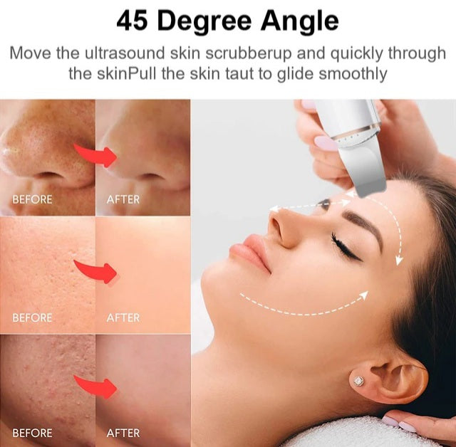 Ultrasonic Ion Skin Scrubber Facial Device