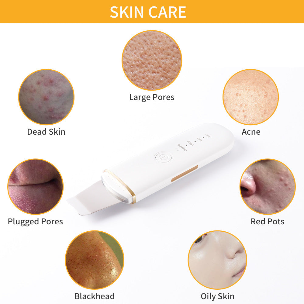 Ultrasonic Ion Skin Scrubber Facial Device