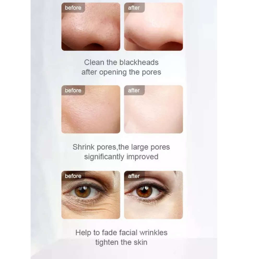 Comparison after using
