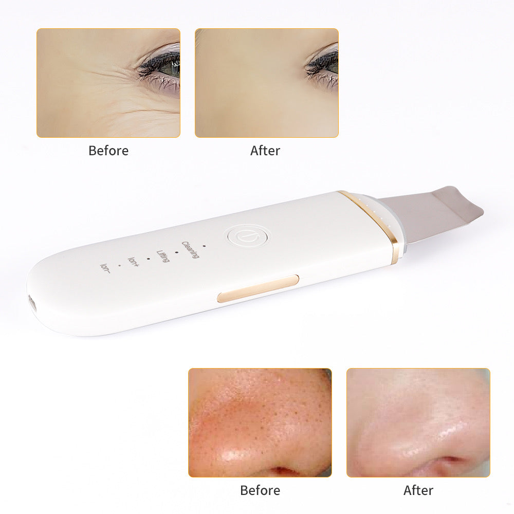 Ultrasonic Ion Skin Scrubber Facial Device