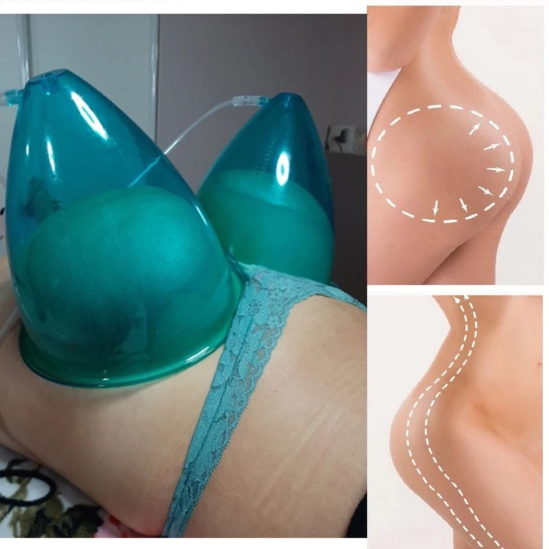 Blue Color Large Cups are applied to Buttocks, Butt Lifting and Enlargement