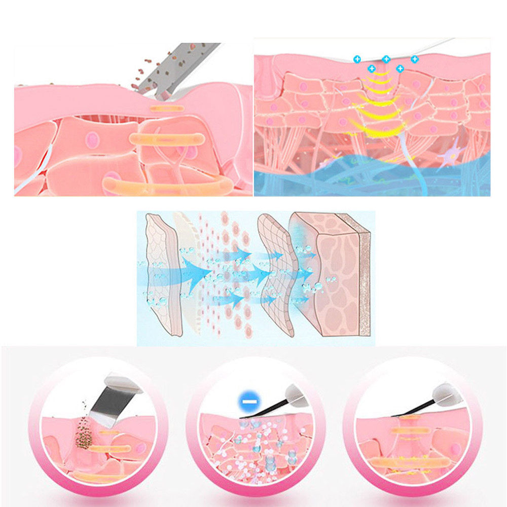 Ultrasonic Ion Skin Scrubber Penatration