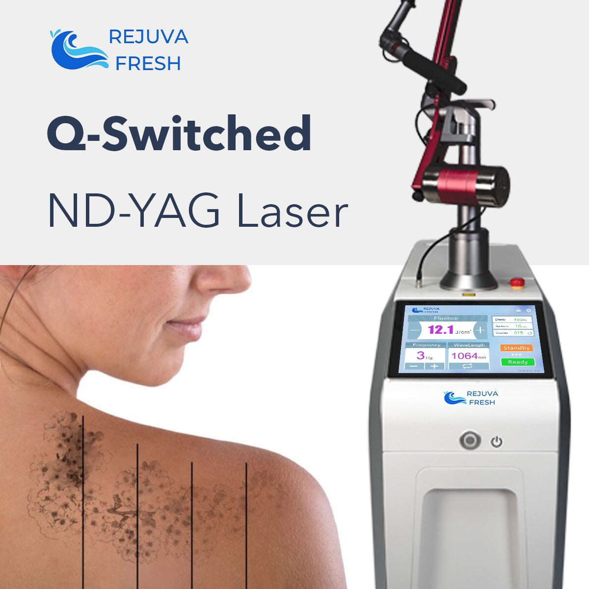 Q-Switched ND-YAG Laser Machine , Tattoo on Shoulders
