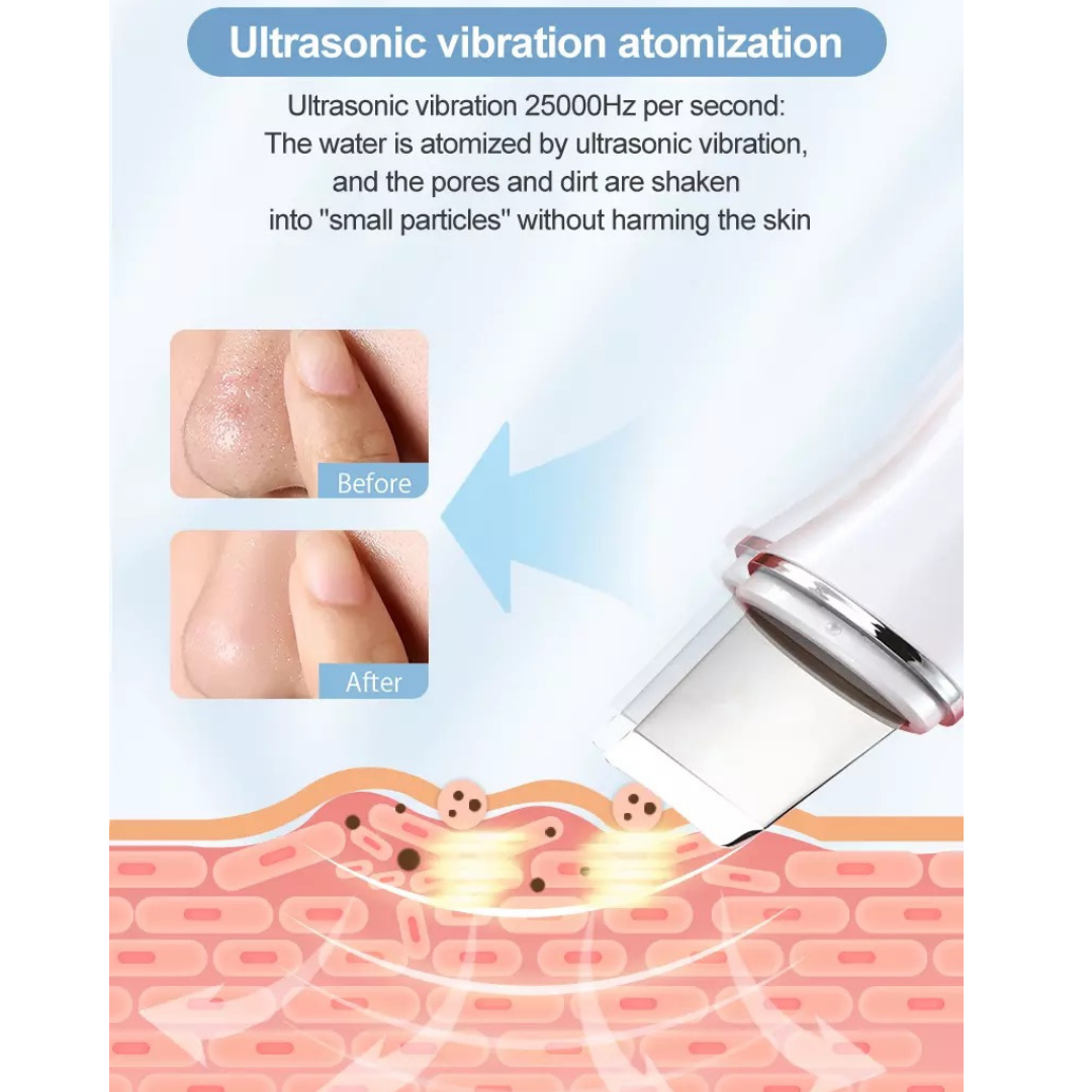 Ultrasonic Vibration Atomization of 25000 hz