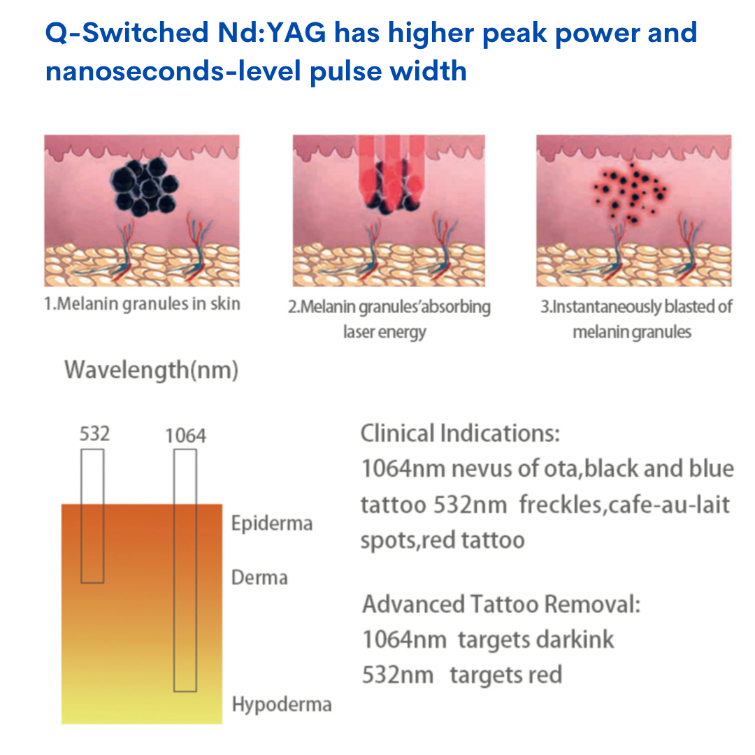 How a switched nd:YAG has super pulse and pulse