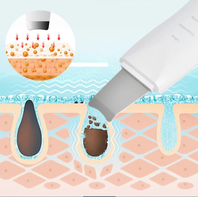 Sonic Exfoliating Wand Facial Device