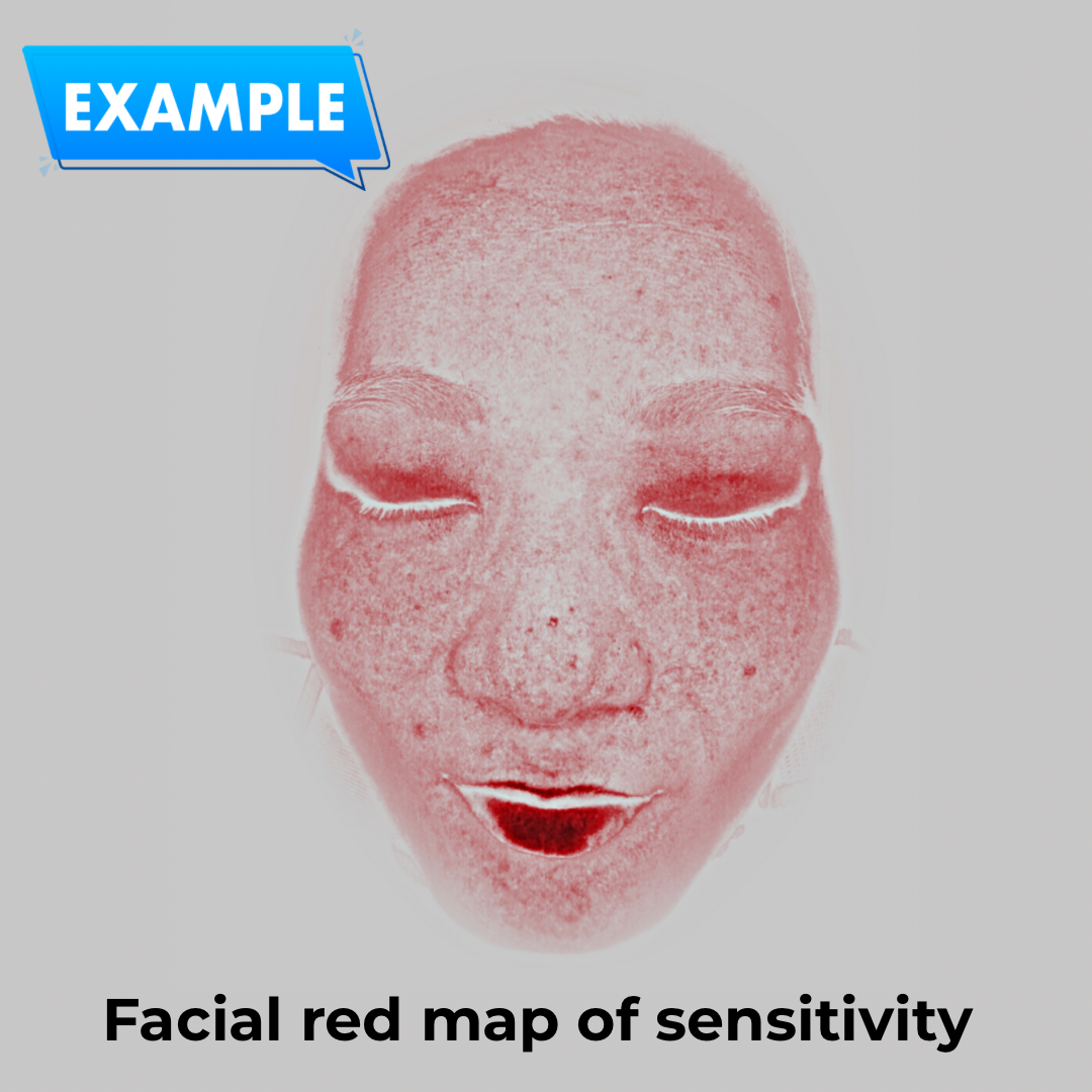 Imagica™ Skin Analyzer & Sharing System