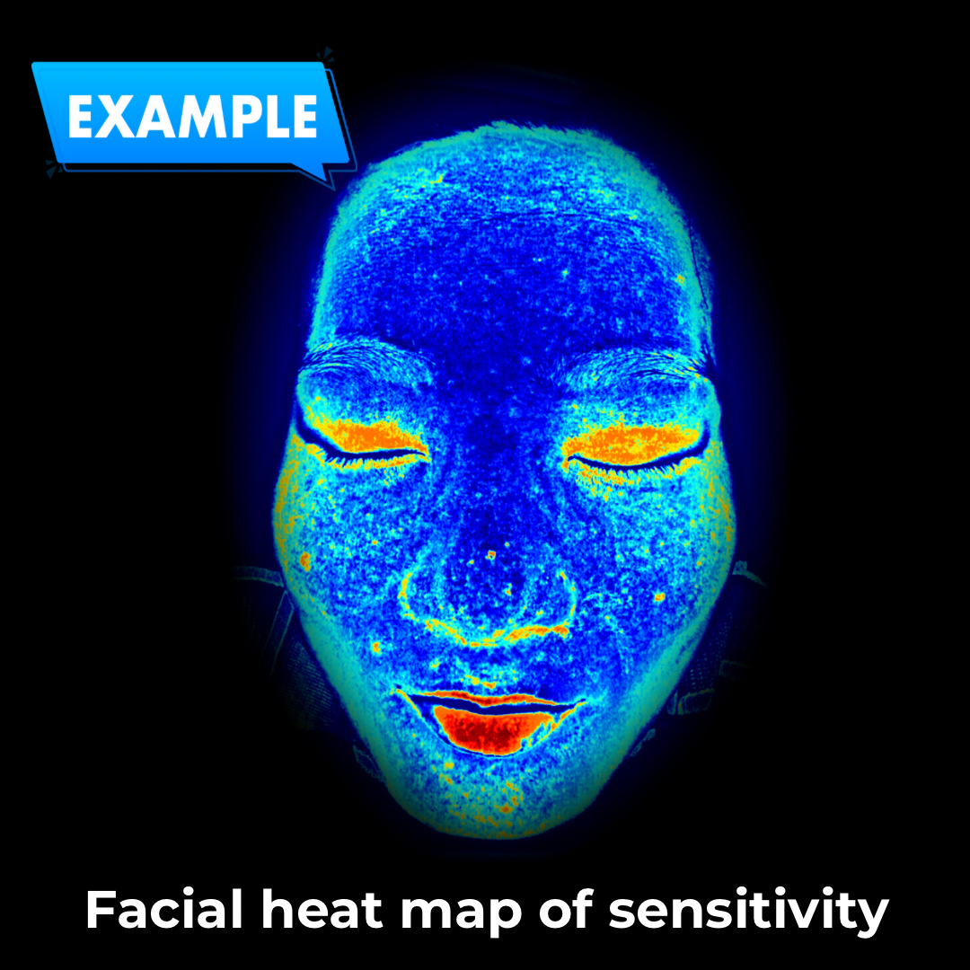 Imagica™ Skin Analyzer & Sharing System